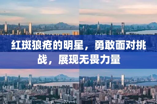 红斑狼疮的明星，勇敢面对挑战，展现无畏力量